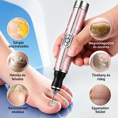 Lima eléctrica para uñas para el tratamiento de la onicomicosis