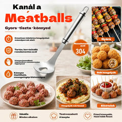 🍖 【2 darabos】304 rozsdamentes acél húsgombóc forma – Ideális hús- és halgombócok készítéséhez, tökéletes otthoni főzéshez 🥄